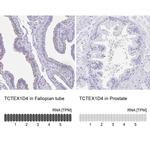 TCTEX1D4 Antibody