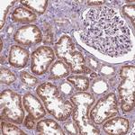 ZNF605 Polyclonal Antibody