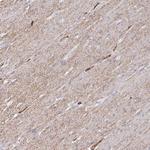 COX16 Antibody in Immunohistochemistry (Paraffin) (IHC (P))