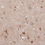 LRRTM1 Polyclonal Antibody