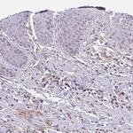 EMC6 Antibody in Immunohistochemistry (Paraffin) (IHC (P))