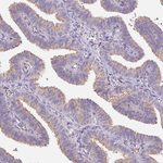 EMC6 Antibody in Immunohistochemistry (Paraffin) (IHC (P))