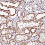 GIPC2 Polyclonal Antibody