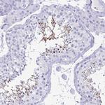 BPIFA3 Polyclonal Antibody