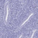 BPIFA3 Antibody in Immunohistochemistry (IHC)