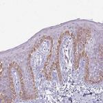 SLC35E2 Polyclonal Antibody