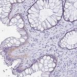 C19orf73 Antibody in Immunohistochemistry (Paraffin) (IHC (P))