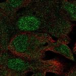 C19orf73 Polyclonal Antibody