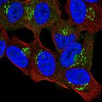 FLJ22184 Polyclonal Antibody