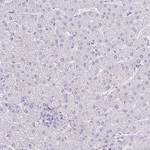 FNTB Antibody in Immunohistochemistry (Paraffin) (IHC (P))