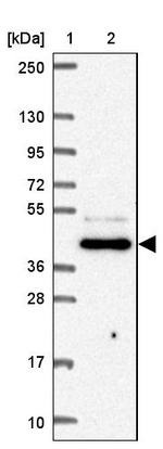 FNTB Antibody in Western Blot (WB)