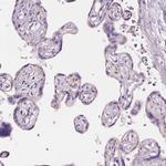 AWAT2 Polyclonal Antibody