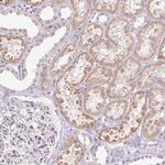 IGFL3 Polyclonal Antibody