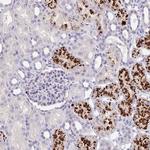 EML6 Polyclonal Antibody