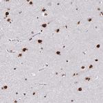ZNF579 Antibody in Immunohistochemistry (Paraffin) (IHC (P))