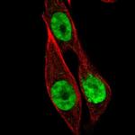 HOXB13 Polyclonal Antibody