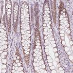 HOXB13 Antibody in Immunohistochemistry (Paraffin) (IHC (P))