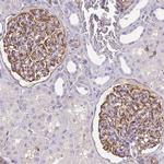 TRPV6 Antibody in Immunohistochemistry (Paraffin) (IHC (P))