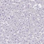 TRPV6 Antibody in Immunohistochemistry (Paraffin) (IHC (P))