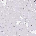 TRPV6 Antibody in Immunohistochemistry (Paraffin) (IHC (P))