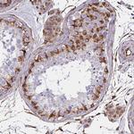 TRPV6 Antibody in Immunohistochemistry (Paraffin) (IHC (P))