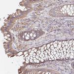 Nkx2.8 Antibody in Immunohistochemistry (IHC)