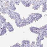 CFAP69 Antibody in Immunohistochemistry (Paraffin) (IHC (P))