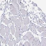 CFAP69 Antibody in Immunohistochemistry (Paraffin) (IHC (P))