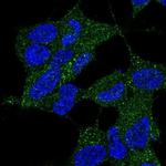 DYNC2LI1 Polyclonal Antibody