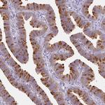 DYNC2LI1 Antibody in Immunohistochemistry (Paraffin) (IHC (P))