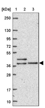 DYNC2LI1 Antibody in Western Blot (WB)