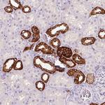 TMEM72 Antibody in Immunohistochemistry (Paraffin) (IHC (P))