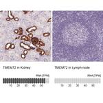 TMEM72 Antibody in Immunohistochemistry (IHC)