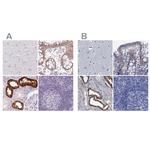 TMEM72 Antibody in Immunohistochemistry (IHC)