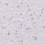 TMEM72 Antibody in Immunohistochemistry (IHC)
