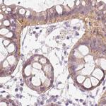 TMEM72 Antibody in Immunohistochemistry (IHC)