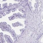 CD164L2 Antibody in Immunohistochemistry (IHC)