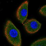 CD164L2 Polyclonal Antibody