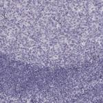 NANOS3 Polyclonal Antibody