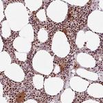 CWC25 Antibody in Immunohistochemistry (IHC)