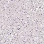 CWC25 Antibody in Immunohistochemistry (IHC)