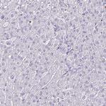 ULBP3 Antibody in Immunohistochemistry (Paraffin) (IHC (P))
