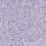 ULBP3 Polyclonal Antibody