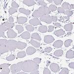 ULBP3 Antibody in Immunohistochemistry (Paraffin) (IHC (P))