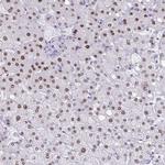 PBOV1 Polyclonal Antibody