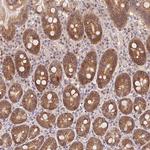 SLC52A2 Antibody in Immunohistochemistry (Paraffin) (IHC (P))