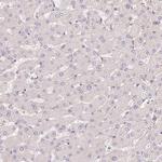 SLC52A2 Antibody in Immunohistochemistry (Paraffin) (IHC (P))