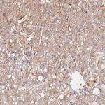 HEPN1 Antibody in Immunohistochemistry (IHC)
