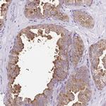 FAM177B Polyclonal Antibody