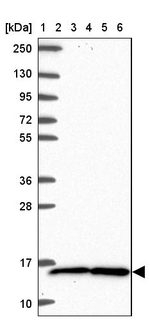 TAX1BP3 Antibody in Western Blot (WB)